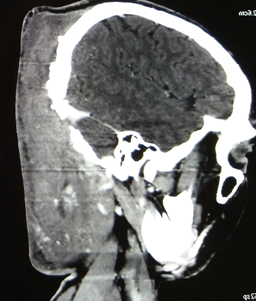 patient CT Scan