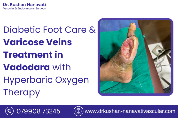 diabetic-foot-treatment-in-vadodara