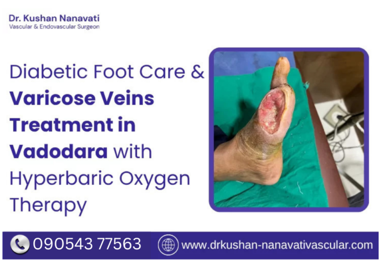 diabetic-foot-treatment-in-vadodara