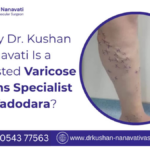 varicose-veins-specialist-in-vadodara