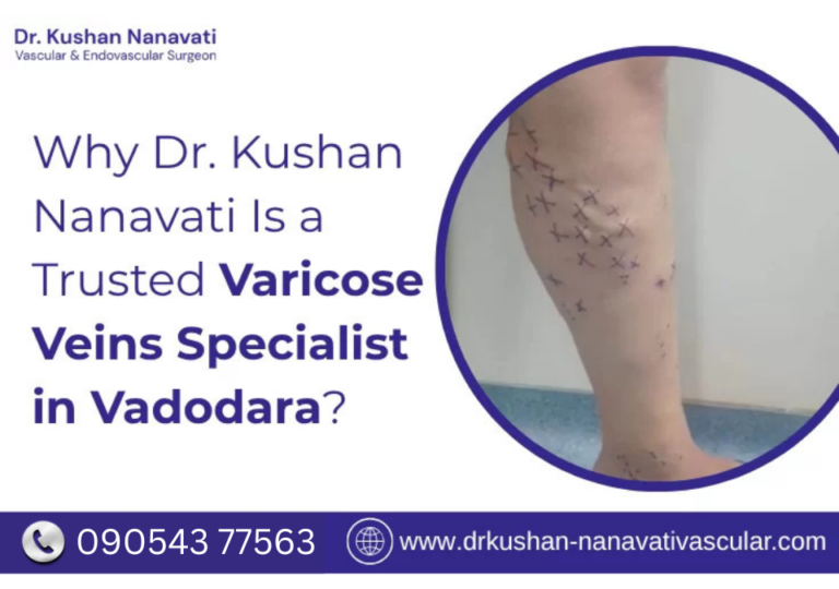 varicose-veins-specialist-in-vadodara