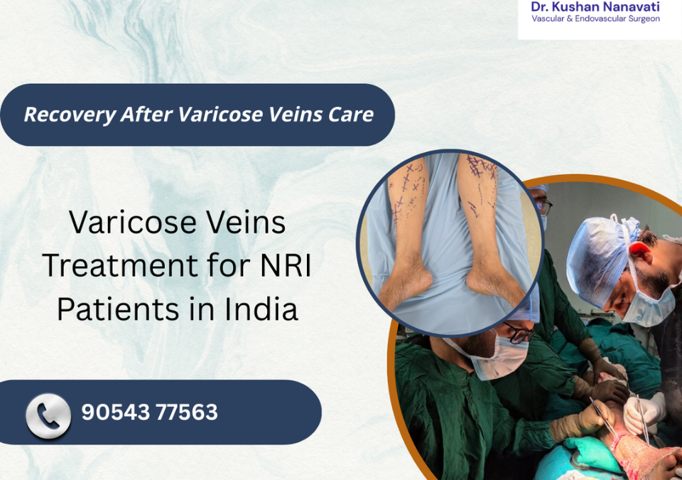 Varicose veins before and after modern treatment in legs