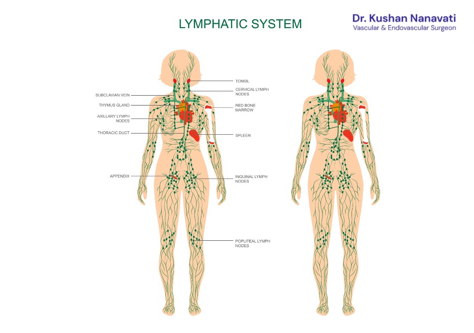 Diagram showing the human lymphatic system and lymph node locations for lymphedema treatment.