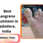 Dr. Kushan Nanavati Vascular Surgeon in Vadodara examining gangrene patient at AADICURA Superspecialist Hospital