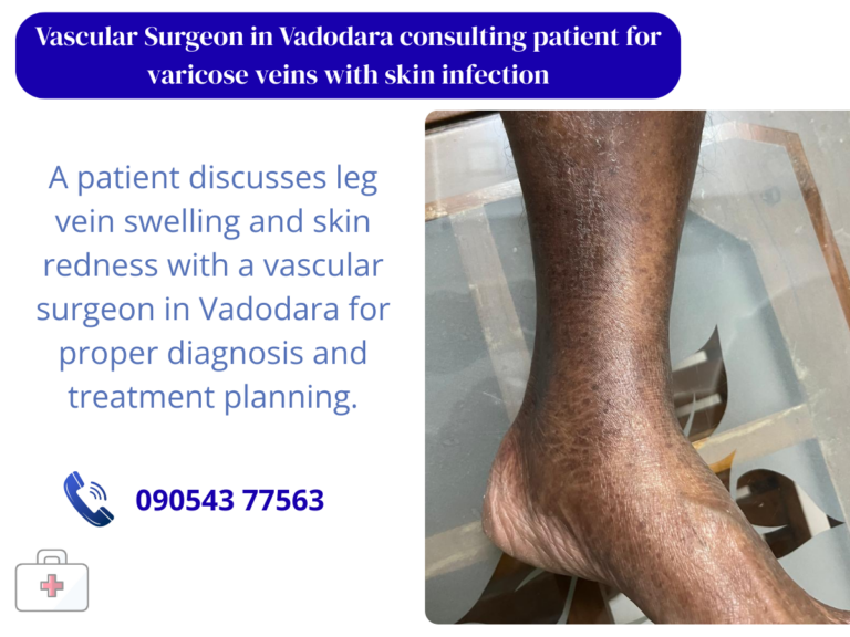 Specialist care for varicose veins with infection in Vadodara.