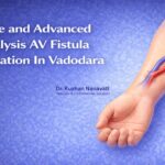 Dialysis AV Fistula creation In Vadodara