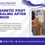 Peripheral Arterial Treatment in Vadodara by Dr. Kushan Nanavati