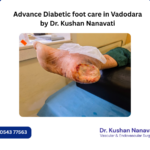 Diabetic foot treatment in Vadodara