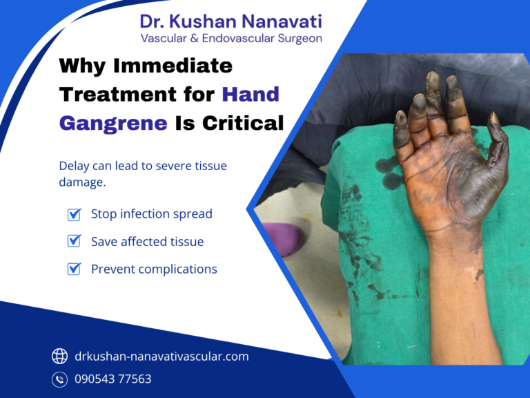 Gangrene Treatment in Vadodara by Dr. Kushan Nanavati