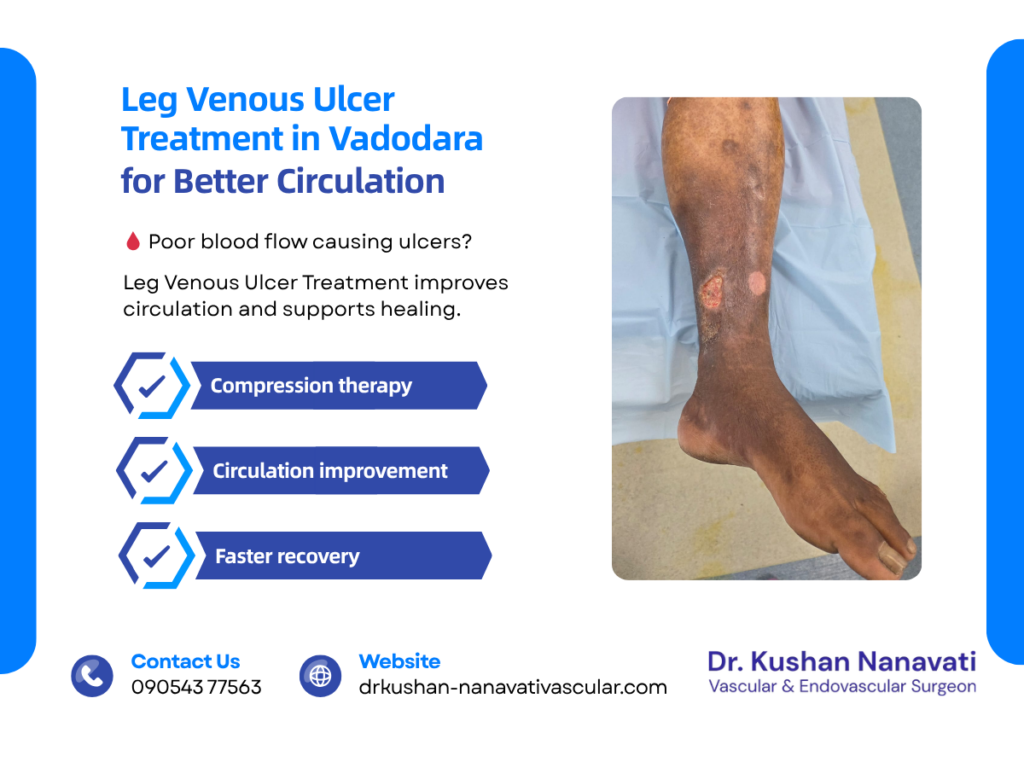 Leg Venous Ulcer Treatment by Dr. Kushan Nanavati