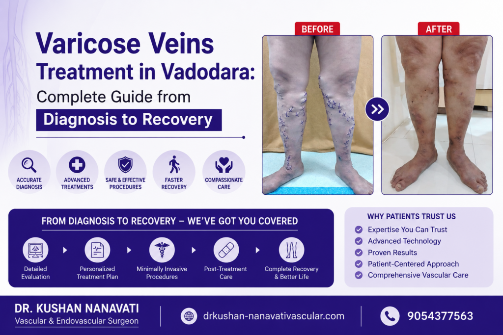 Varicose Veins Treatment in Vadodara: Complete Guide from Diagnosis to Recovery