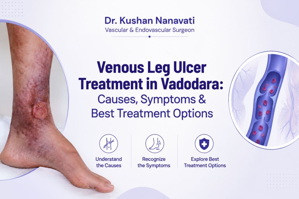 Venous Leg Ulcer Treatment in Vadodara - Causes, Symptoms & Best Treatment Options