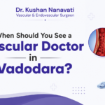 When Should You See a Vascular Doctor in Vadodara?