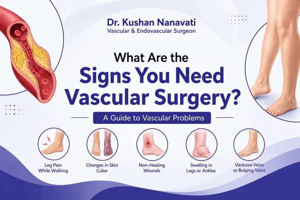 What Are the Signs You Need Vascular Surgery? A Guide to Vascular Problems
