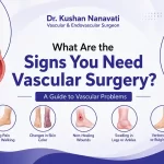 What Are the Signs You Need Vascular Surgery? A Guide to Vascular Problems