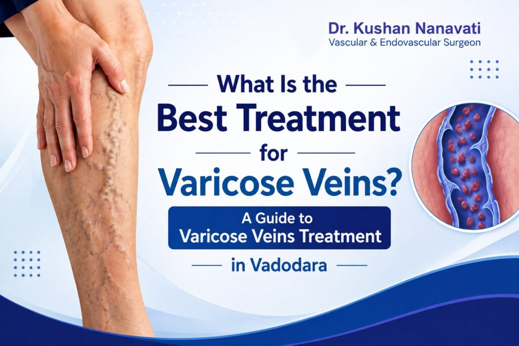 What Is the Best Treatment for Varicose Veins? A Guide to Varicose Veins Treatment in Vadodara