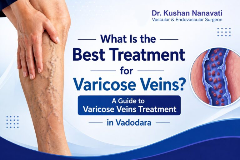 What Is the Best Treatment for Varicose Veins? A Guide to Varicose Veins Treatment in Vadodara