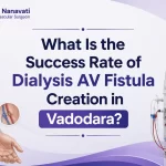 What Is the Success Rate of Dialysis AV Fistula Creation in Vadodara