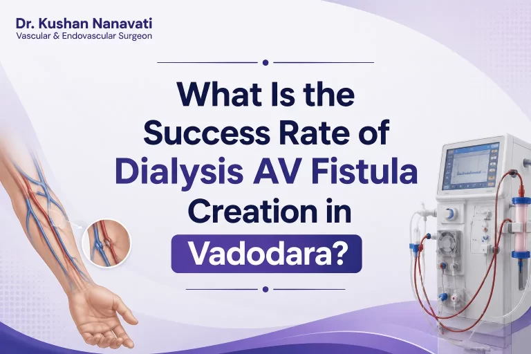 What Is the Success Rate of Dialysis AV Fistula Creation in Vadodara