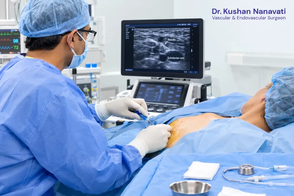 Chemoport placement procedure performed by a vascular specialist
