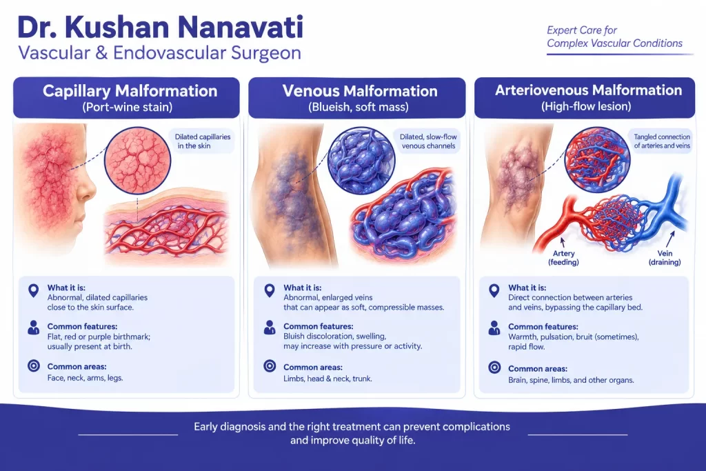 Types of vascular malformations including capillary venous and arteriovenous malformations