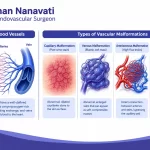 Vascular malformations explained with abnormal blood vessel illustration