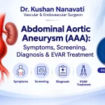 Abdominal Aortic Aneurysm (AAA)- Symptoms, Screening, Diagnosis and EVAR Treatment